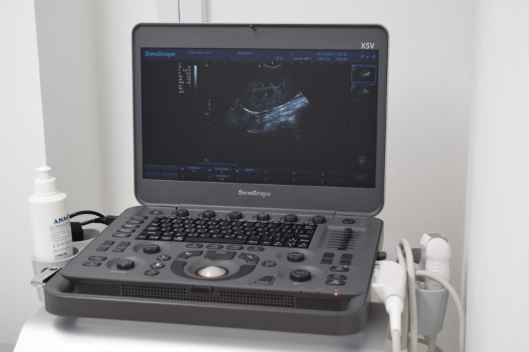 Ultrasound